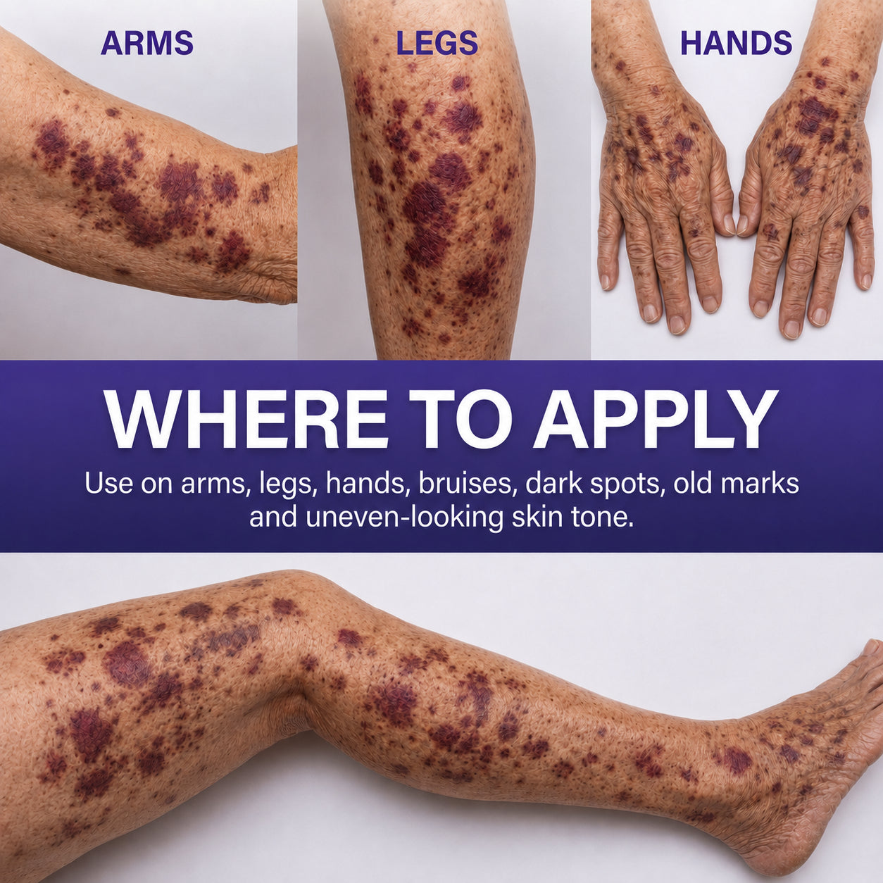 🔥Last Day-Buy 1 Get 1 Free🔥Skin-Strengthening Bruise Cream