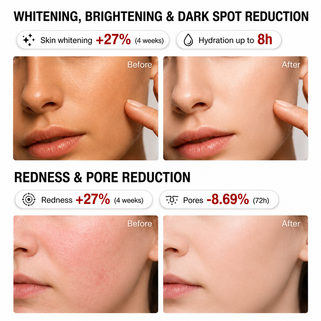 Last Day-Buy 1 Get 1 Free💙Niacinamide Brightening Essence, Reduces Acne Scars and Dark Spots, Whitening Serum
