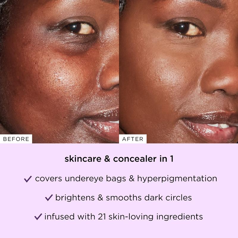 Buy 1 Get 1 Free🔥Soft Sculpt Blur Concealer Stick