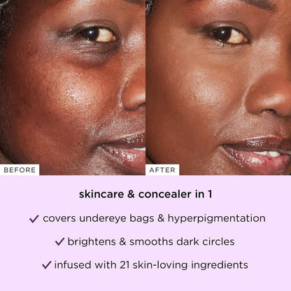 Buy 1 Get 1 Free🔥Soft Sculpt Blur Concealer Stick